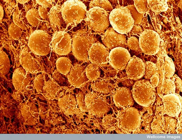 Micrografía por barrido electrónico de tejido adiposo (obesidad), donde se observan las células adiposas en color naranja. 
