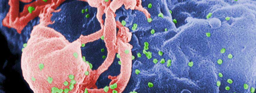 Virus sida (en rosa) atacando un tejido (en azul).