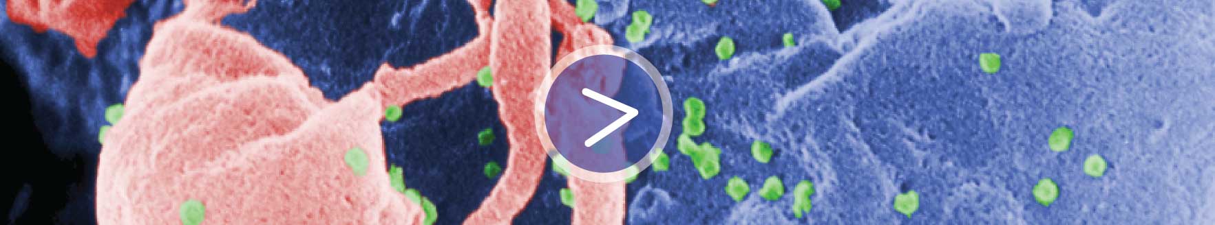 Virus sida (en rosa) atacando un tejido (en azul). Símbolo "play" en medio.