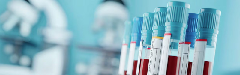 Tubos de ensayo en laboratorio para hacer un análisis de sangre