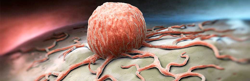 célula cancerígena