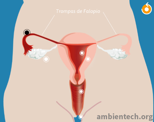 Representación gráfica del aparato reproductor femenino. Se señala la ubicación de las trompas de falopio con una flecha.