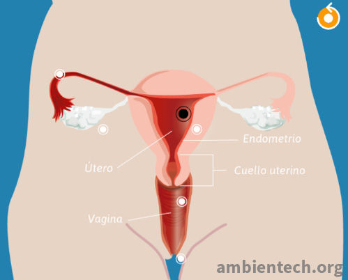 Representación gráfica del aparato reproductor femenino. Se señala la ubicación del útero con una flecha, además también se señala endometrio, cuello uterino y vaginapara distinguirlos del útero.