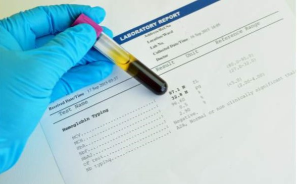 resultados analitica sangre hematocritos